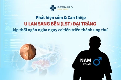 Phát hiện SỚM & Can thiệp u lan sang bên (LST) đại tràng - Kịp thời ngăn ngừa nguy cơ tiến triển thành ung thư
